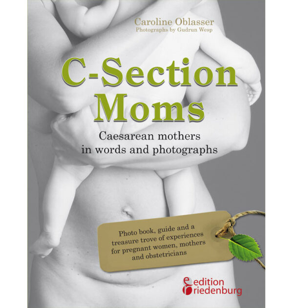 C-Section Moms